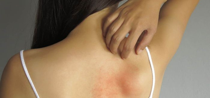 Fibromialgia ganha diretrizes ampliadas de tratamento no SUS