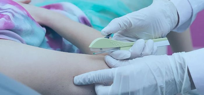 Blumenau oferece novo implante contraceptivo gratuito pelo SUS