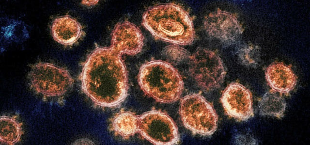 Deltacron: nova cepa do coronavírus é identificada no Chipre