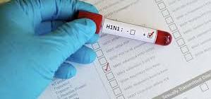 Mais dois óbitos pelo vírus H1N1 são confirmados em Blumenau